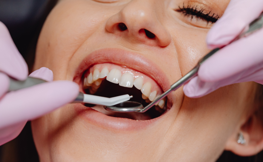 Are Dental Implants Safe?